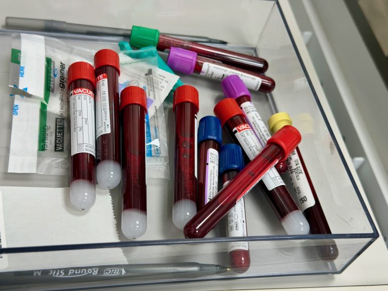 A Simple Blood Test Could Flag Crohn’s a Decade Before Symptoms Blood test samples prepared for laboratory analysis